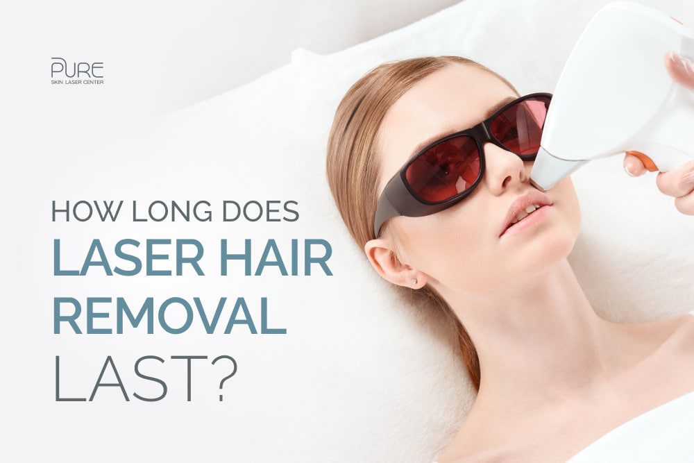 how long does laser hair removal last in North Hollywood