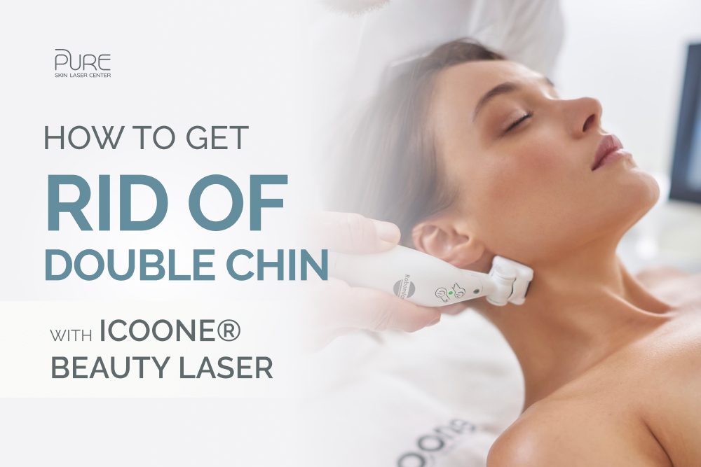 How To Get Rid of Double Chin with icoone®Beauty Laser