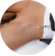 Excessive sweating <br>(hyperhidrosis)