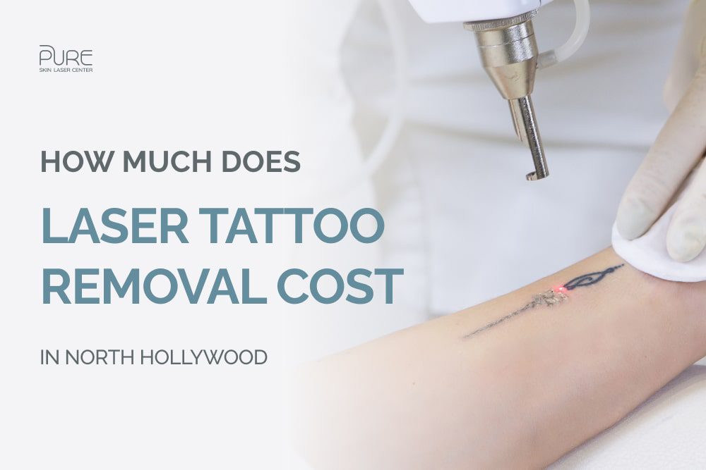 How much would it cost to get a face tattoo removed? - Quora